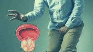 Akut Prostatitis