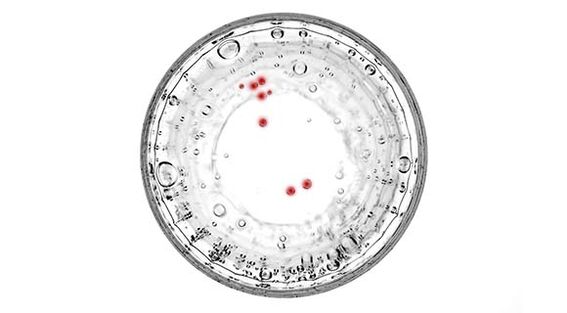 Wann Dir Symptomer vun der Prostatitis hutt, sollt Dir fir verstoppte Infektiounen getest ginn.